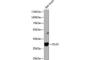 Western blot analysis of extracts of rat brain, using DLX2 antibody  at 1:1000 dilution. (DLX2 antibody  (AA 1-140))
