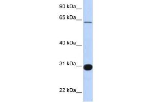 WB Suggested Anti-RALGPS1 Antibody Titration:  0. (RALGPS1 antibody  (Middle Region))