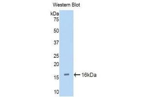 Western Blotting (WB) image for anti-Cubilin (Intrinsic Factor-Cobalamin Receptor) (CUBN) (AA 3511-3623) antibody (ABIN1858562) (CUBN antibody  (AA 3511-3623))