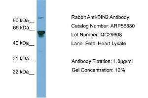 WB Suggested Anti-BIN2  Antibody Titration: 0. (BIN2 antibody  (Middle Region))