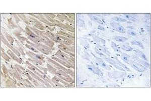 Immunohistochemistry analysis of paraffin-embedded human heart tissue, using MRPL16 Antibody. (MRPL16 antibody  (AA 171-220))