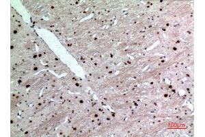 Immunohistochemistry (IHC) analysis of paraffin-embedded Rat Brain, antibody was diluted at 1:100. (KRT14 antibody  (C-Term))