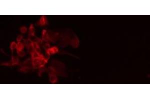 ABIN6275729 staining A549 cells by IF/ICC. (PPFIBP1 antibody  (Internal Region))