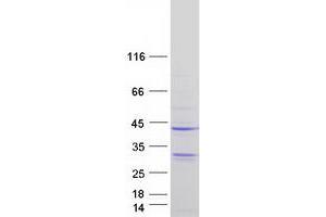 Validation with Western Blot