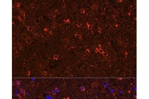 Immunofluorescence analysis of Rat brain using GAD2 Polyclonal Antibody at dilution of 1:100 (40x lens). (GAD65 antibody)