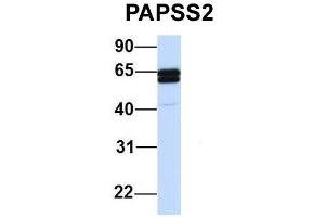Host:  Rabbit  Target Name:  PAPSS2  Sample Type:  Human 721_B  Antibody Dilution:  1. (PAPSS2 antibody  (C-Term))