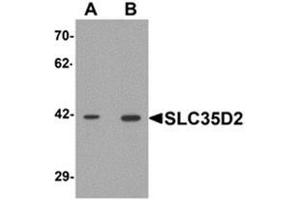 Western blot analysis of SLC35D2 in HeLa cell lysate with SLC35D2 Antibody  at (A) 1 and (B) 2 μg/ml.