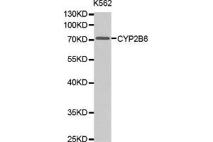 Western Blotting (WB) image for anti-Cytochrome P450, Family 2, Subfamily B, Polypeptide 6 (CYP2B6) (AA 160-340) antibody (ABIN1679474)