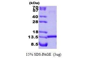 Figure annotation denotes ug of protein loaded and % gel used. (HINT1 Protein (AA 1-126))