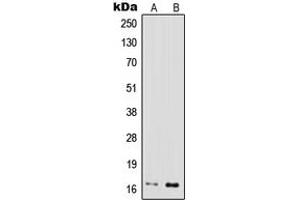 Western blot analysis of IFN gamma expression in MOLT4 (A), Jurkat (B) whole cell lysates. (Interferon gamma antibody  (Center))