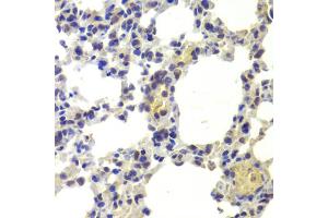 Immunohistochemistry of paraffin-embedded mouse lung using HDAC5 antibody (ABIN6290464) at dilution of 1:100 (40x lens). (HDAC5 antibody)
