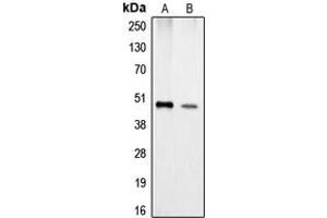 Western blot analysis of Carboxypeptidase A1 expression in Jurkat (A), HeLa (B) whole cell lysates.
