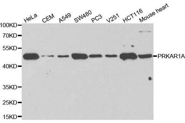 PRKAR1A Antikörper  (AA 1-250)