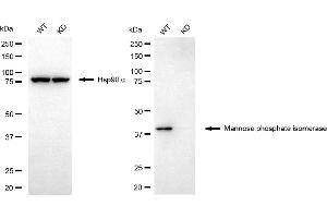 Western blotting analysis using mannose phosphate isomerase antibody (ABIN7799328). (MPI antibody)