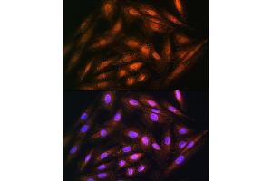 Immunofluorescence analysis of H9C2 cells using DUSP14 Rabbit pAb (ABIN6127789, ABIN6139865, ABIN6139866 and ABIN6214482) at dilution of 1:100. (DUSP14 antibody  (AA 1-198))