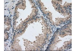 Immunohistochemical staining of paraffin-embedded colon tissue using anti-PDE4A mouse monoclonal antibody. (PDE4A antibody)