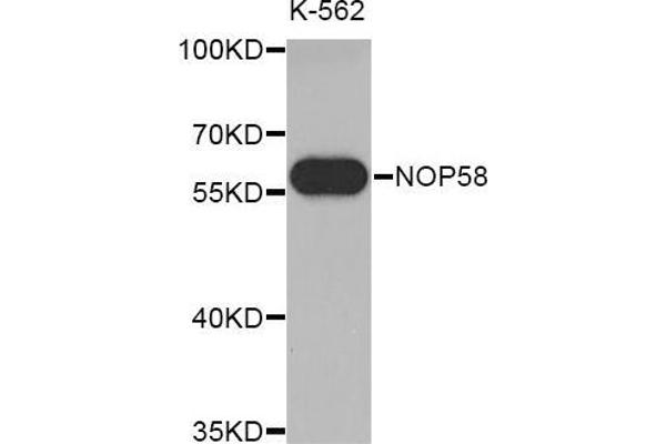 NOP58 antibody  (AA 360-529)