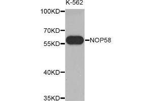 Western blot analysis of extracts of K-562 cell line, using NOP58 antibody. (NOP58 antibody  (AA 360-529))