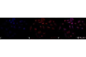 Immunocytochemistry/Immunofluorescence analysis using Mouse Anti-Hsp47 Monoclonal Antibody, Clone 1C4-1A6 . (SERPINH1 antibody)
