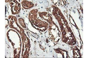 Immunohistochemical staining of paraffin-embedded Human Kidney tissue using anti-KCNAB1 mouse monoclonal antibody.