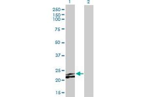 Western Blot analysis of FGF23 expression in transfected 293T cell line by FGF23 MaxPab polyclonal antibody. (FGF23 antibody  (AA 1-251))