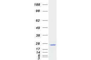 Western Blotting (WB) image for SAR1 Homolog A (SAR1A) (Transcript Variant 2) protein (Myc-DYKDDDDK Tag) (ABIN2731396)