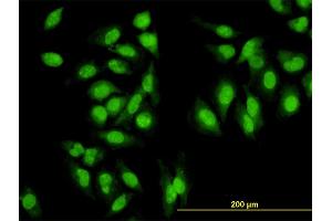 Immunofluorescence of monoclonal antibody to SYMPK on HeLa cell. (Symplekin antibody  (AA 1-533))