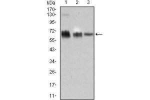 Western Blotting (WB) image for anti-TRAF-Type Zinc Finger Domain Containing 1 (TRAFD1) (AA 401-582) antibody (ABIN1845342)