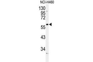 Western blot analysis of ADRA1B Antibody (Center) in NCI-H460 cell line lysates (35µg/lane).