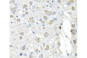 Immunohistochemistry of paraffin-embedded Rat brain using BAG5 Polyclonal Antibody at dilution of 1:100 (40x lens). (BAG5 antibody)
