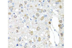 Immunohistochemistry of paraffin-embedded Rat brain using BAG5 Polyclonal Antibody at dilution of 1:100 (40x lens). (BAG5 antibody)