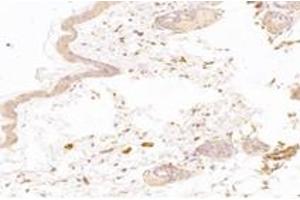 Immunohistochemistry (Paraffin-embedded Sections) (IHC (p)) image for anti-5'-Nucleotidase, Cytosolic IB (NT5C1B) antibody (ABIN7072861)