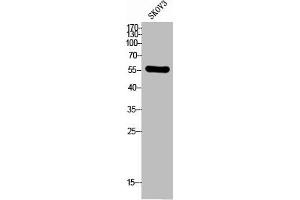 Western Blot analysis of SKOV3 cells using CD292 Polyclonal Antibody (BMPR1A antibody  (N-Term))