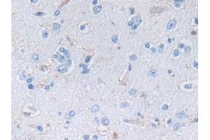 Detection of NES in Human Cerebrum Tissue using Polyclonal Antibody to Nestin (NES) (Nestin antibody  (AA 178-399))