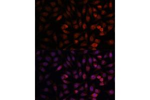 Immunofluorescence analysis of L929 cells using DDX24 antibody (ABIN7266691) at dilution of 1:100. (DDX24 antibody  (AA 510-859))