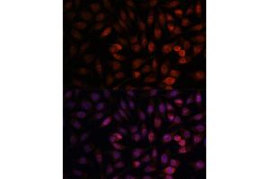 Immunofluorescence analysis of L929 cells using DDX24 antibody (ABIN7266691) at dilution of 1:100. (DDX24 antibody  (AA 510-859))