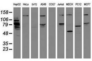 Image no. 4 for anti-Mitochondrial Intermediate Peptidase (MIPEP) (AA 174-516) antibody (ABIN1491019) (MIPEP antibody  (AA 174-516))