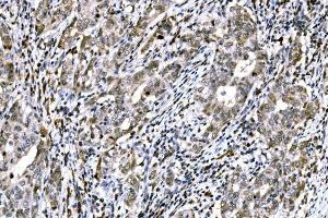 IHC analysis of RAD18 using anti-RAD18 antibody (ABIN7599364). (RAD18 antibody  (AA 1-408))