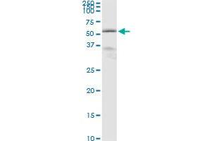 Immunoprecipitation of BCS1L transfected lysate using anti-BCS1L monoclonal antibody and Protein A Magnetic Bead , and immunoblotted with BCS1L MaxPab rabbit polyclonal antibody. (BCS1L antibody  (AA 320-418))