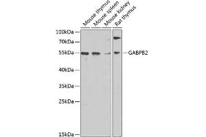 Western blot analysis of extracts of various cell lines, using G antibody (ABIN6130410, ABIN6140895, ABIN6140896 and ABIN6220279) at 1:1000 dilution. (GABPB2 antibody  (AA 239-448))