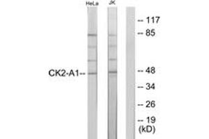 Western blot analysis of extracts from HeLa/Jurkat cells, using Casein Kinase II alpha (Ab-255) Antibody. (CSNK2A1/CK II alpha antibody  (AA 221-270))