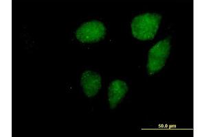 Immunofluorescence of purified MaxPab antibody to VCX3A on HeLa cell. (VCX3A antibody  (AA 1-166))