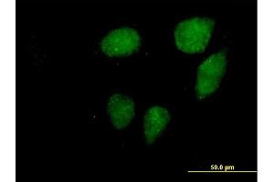 Immunofluorescence of purified MaxPab antibody to VCX3A on HeLa cell.
