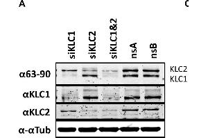The effect of KLC knock-down by siRNA on virus egress. (KLC1 antibody)