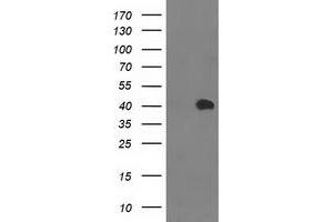 Western Blotting (WB) image for anti-Monoglyceride Lipase (MGLL) antibody (ABIN1499439)