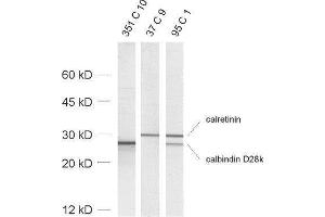 dilution: 1 : 1000, sample: rat brain homogenate (Calbindin D28k/D29k antibody)