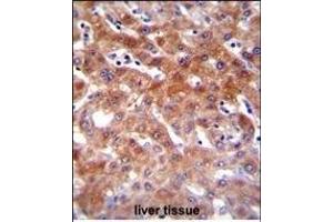 CYP1A2 Antibody (Center) (ABIN655272 and ABIN2844864) immunohistochemistry analysis in formalin fixed and paraffin embedded human liver tissue followed by peroxidase conjugation of the secondary antibody and DAB staining. (CYP1A2 antibody  (AA 255-282))