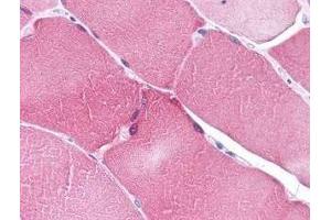 Immunohistochemistry of ARC in human heart tissue (A) and skeletal muscle (B) with ARC antibody at 5 μg/ml. (NOL3 antibody  (C-Term))