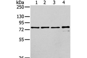 Western Blot analysis of Raji, K562, skov3 and pc3 cell using GHR Polyclonal Antibody at dilution of 1/400 (Growth Hormone Receptor antibody)