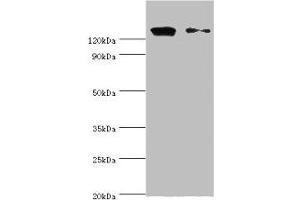 Western blot All lanes: CCAR1 antibody at 10 μg/mL Lane 1: Hela whole cell lysate Lane 2: PC-3 whole cell lysate Secondary Goat polyclonal to rabbit IgG at 1/10000 dilution Predicted band size: 133, 132 kDa Observed band size: 133 kDa